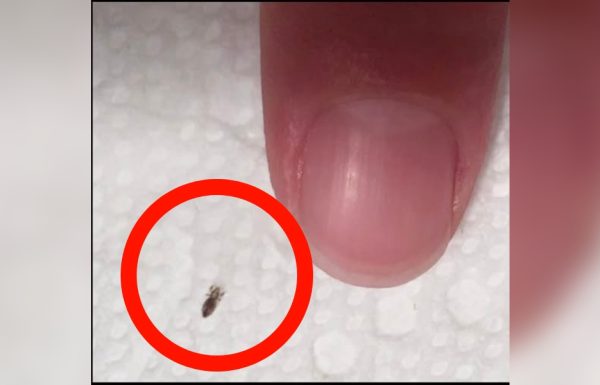 ”אשתי מצאה את החרק הזה בשיער של הילד. האם יש סיבה לדאגה? הוא הולך לגן 5 ימים בשבוע..”