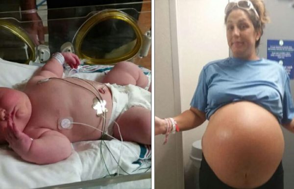 אמא ילדה תינוקת שוברת שיאים שהדהימה את הרופא שיילד אלפי תינוקות