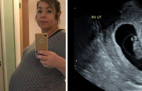 אמא לא הצליחה להיכנס להריון במשך 7 שנים, אבל כמעט התעלפה כאשר הרופא הראה לה את האולטרסאונד