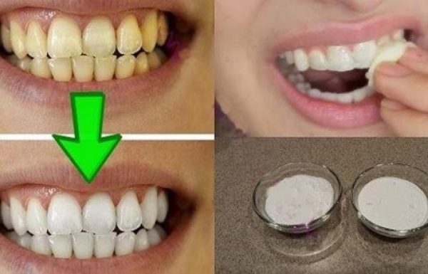 סובלים משיניים צהובות? התרופה הביתית והטבעית הזו תלבין לכם את השיניים תוך 2 דקות בלבד!