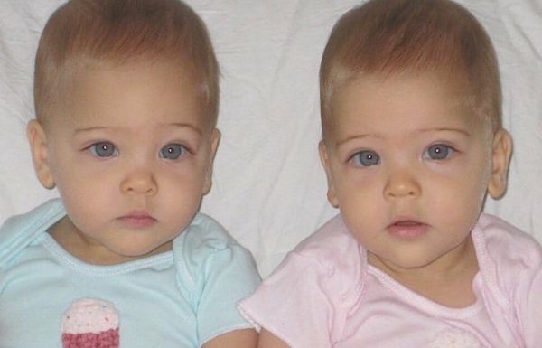 תאומות זהות נולדו בשנת 2010: היום הן כמעט בנות 8 ונחשבות ל'תאומות הכי יפות בעולם'