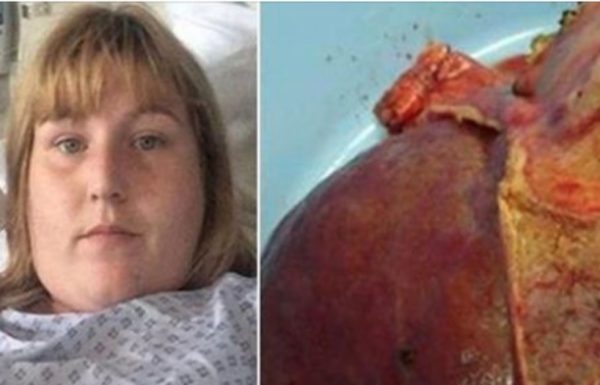 אמא לפתע התעלפה במטבח – בבית החולים הרופאים בדקו את הכבד שלה וגילו את סודה האפל