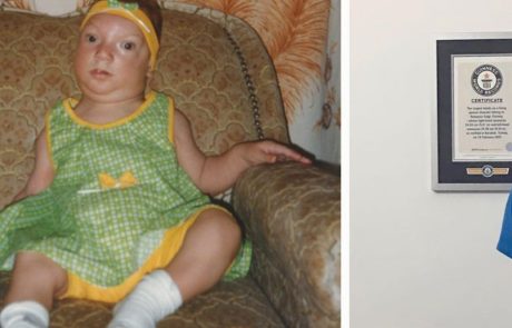 הרופאים נדהמו: התינוקת שנולדה עם מוטציה נדירה והפכה לאישה הגבוהה בעולם – כך היא נראית היום