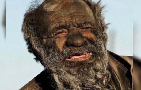 כינו אותו ‘האיש המלוכלך בעולם’ לאחר שלא התרחץ במשך 67 שנים. כשרופאים בדקו אותו, הם היו בשוק ממה שמצאו
