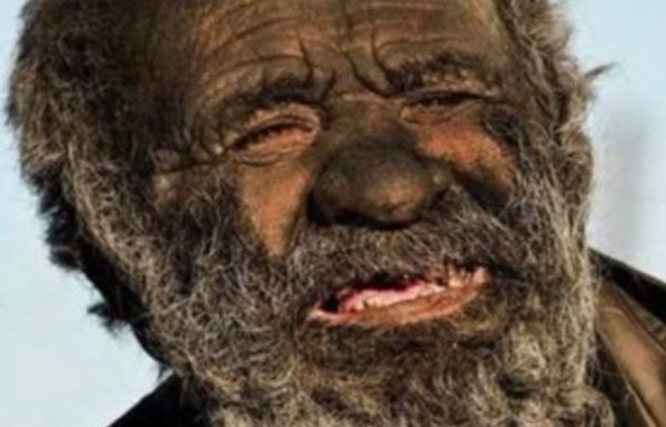 הוא לא התקלח במשך יותר מ 60 שנה – הסיבה שלו הדהימה את כולם, ומה שקרה אחרי האמבטיה הראשונה הפך את הסיפור למצמרר עוד יותר