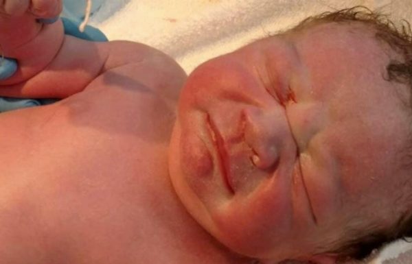 הרופאים נדהמו כשהתינוק נולד: אז הם הסתכלו מאחורי הרחם של אמא ומצאו את הבלתי ייאמן