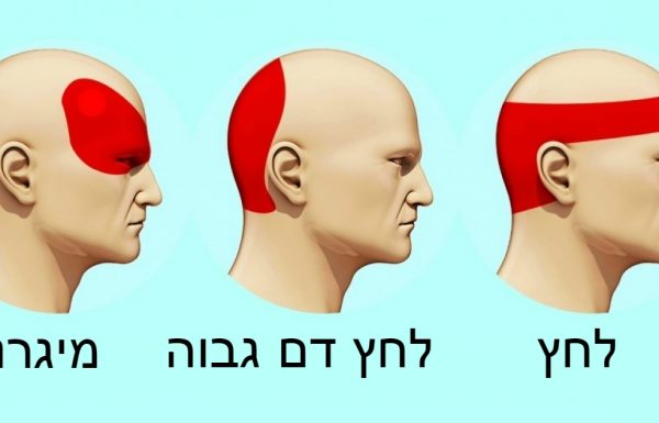 איך להיפטר מכאב ראש תוך 5 דקות בלי שימוש בכדורים