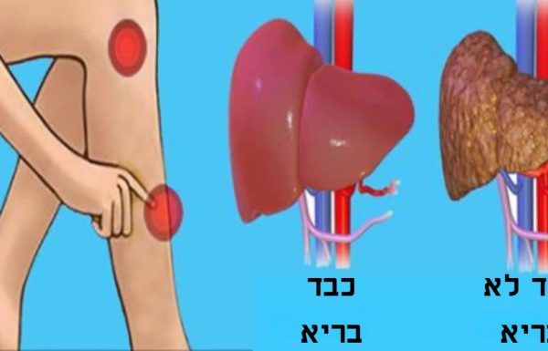 סימן האזהרה החבוי של הגוף – איך לדעת אם הכבד שלכם מלא ברעלים