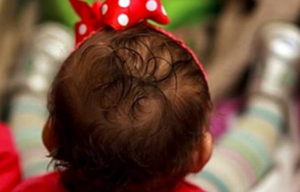 תינוקת בת 14 שבועות מתה בגלל מה שאמא שלה שמה על הראש שלה