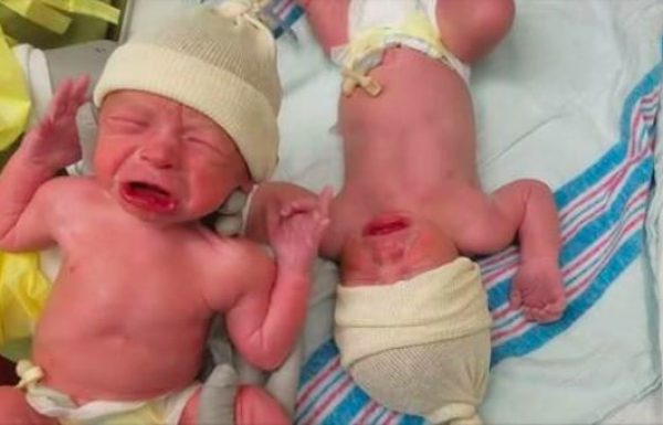 שניות אחרי הלידה תאומים שנולדו זה עתה הדהימו את כולם וגרמו לאבא לרוץ להביא את המצלמה