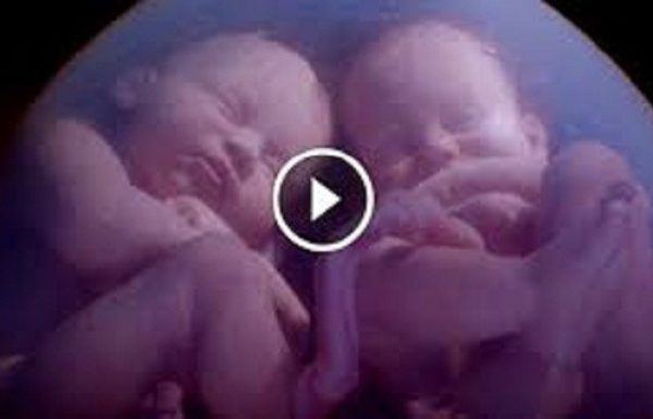 בדיקת MRI שגרתית גילתה תאומים עושים דבר מדהים בתוך הרחם של אמא שלהם