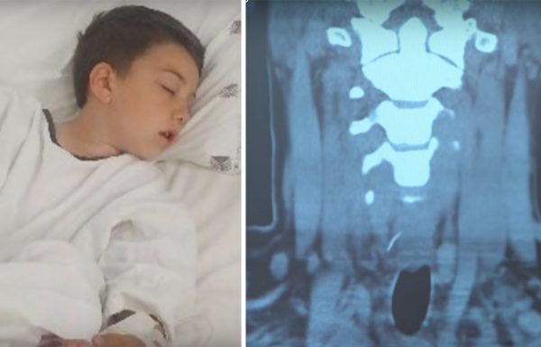 ילד סבל מכאב חד בגרון – ואז הרופאים היו בשוק ממה שהם ראו בצילום הרנטגן