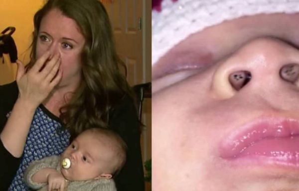 אמא הבחינה בנקודות שחורות מוזרות בתוך האף של בנה התינוק – ואז גילתה את האמת המפחידה