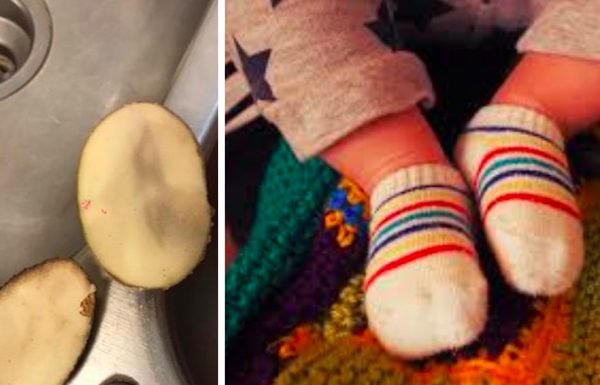 אמא שמה תפוחי אדמה בגרביים של התינוק החולה, יום למחרת היא שיתפה איך הם נראים בפייסבוק