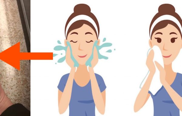 להעלים כתמי גיל וקמטים ב-5 שקלים? הטריק הביתי שרופאי העור לא רוצים שתכירו!