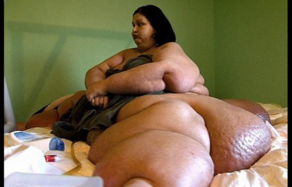‘הרוצחת’ במשקל חצי טון הורידה כמעט 400 ק”ג ממשקל גופה וזכתה להתחלה חדשה לחיים