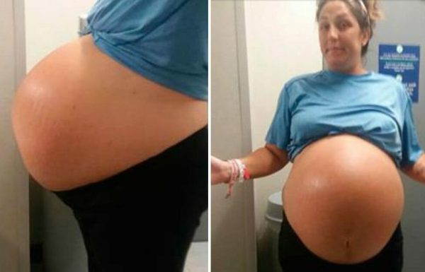 אמא הובהלה לבית החולים כדי ללדת: כשהרופאים ראו מה יש לה בתוך הבטן, הם צרחו